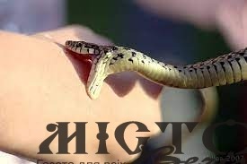 На Львівщині дитина потрапила до реанімації через укус змії 