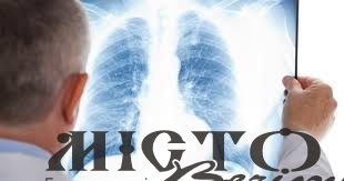 У березні в Україні у 957 людей вперше виявили туберкульоз 