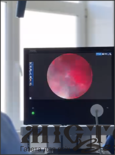 У Нововолинській лікарні з’явилося сучасне обладнання для малоінвазивних ЛОР-операцій 