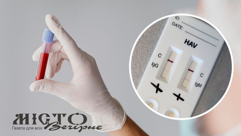 Жителів п'яти громад Волині запрошують безоплатно протестуватися на гепатити 