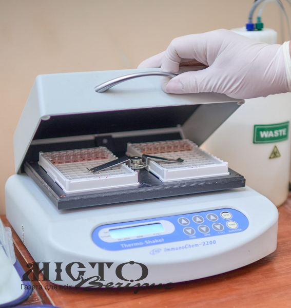 Які імунологічні дослідження проводять у Володимирському ТМО 