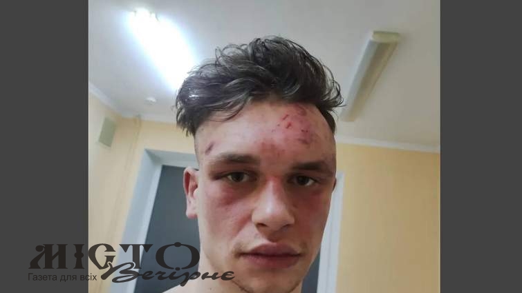 Двоє поліцейських у лісі побили стендап коміка: що вирішив суд 