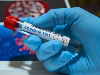 У Володимирі-Волинському та районі зафіксовано 44 нових випадки інфікування коронавірусом 