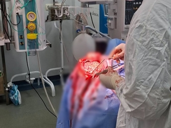 У Володимирі чоловіку провели надскладну операцію на головному мозку 