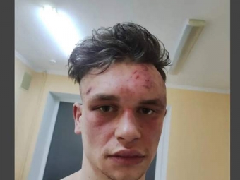 Двоє поліцейських у лісі побили стендап коміка: що вирішив суд 